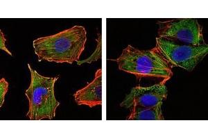 Immunofluorescence analysis of U251 (left) and NTERA2 (right) cells using CRTC1 antibody (green). (CRTC1 Antikörper)