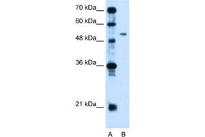 Western Blotting (WB) image for anti-Pregnancy Specific beta-1-Glycoprotein 1 (PSG1) antibody (ABIN2462566) (PSG1 Antikörper)