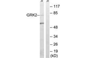 Western blot analysis of extracts from Jurkat cells, using GRK2 (Ab-685) Antibody. (GRK2 Antikörper  (AA 640-689))
