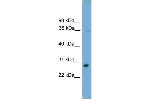 WB Suggested Anti-ZNF37A Antibody Titration:  0. (ZNF37A Antikörper  (Middle Region))