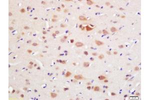 Formalin-fixed and paraffin embedded rat brain labeled with Rabbit Anti-DAL1 Polyclonal Antibody, Unconjugated (ABIN761021) at 1:200 followed by conjugation to the secondary antibody and DAB staining (EPB41L3 Antikörper)