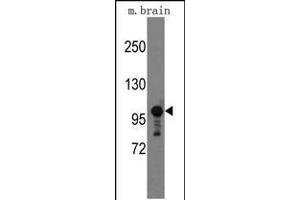 Western blot analysis of mouse anti-Semaphorin 5A Pab (ABIN389166 and ABIN2839332) in mouse brain tissue lysates (35 μg/lane). (SEMA5A Antikörper  (AA 1006-1035))
