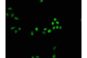 Immunofluorescence staining of Hela cells with ABIN7160246 at 1:33, counter-stained with DAPI.