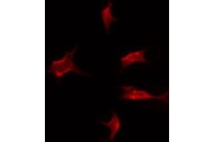 anti-Solute Carrier Family 4 (Anion Exchanger), Member 1, Adaptor Protein (SLC4A1AP) (C-Term) antibody