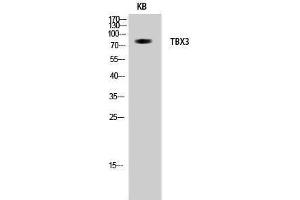 Western Blotting (WB) image for anti-T-Box 3 (TBX3) (Internal Region) antibody (ABIN3177644) (TBX3 Antikörper  (Internal Region))
