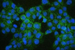 IF analysis of COMT using anti-COMT antibody (ABIN7601948). (COMT Antikörper  (AA 52-271))