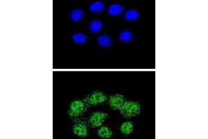 Immunofluorescence (IF) image for anti-Mismatch Repair Protein 2 (MSH2) antibody (ABIN2996263) (MSH2 Antikörper)