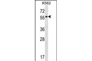 RARB Antibody (Center) (ABIN1537931 and ABIN2849656) western blot analysis in K562 cell line lysates (35 μg/lane). (Retinoic Acid Receptor beta Antikörper  (AA 168-195))