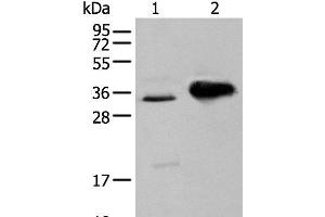 Western blot analysis of TM4 cell and Mouse brain tissue using ATP6V1E2 Polyclonal Antibody at dilution of 1:400 (ATP6V1E2 Antikörper)