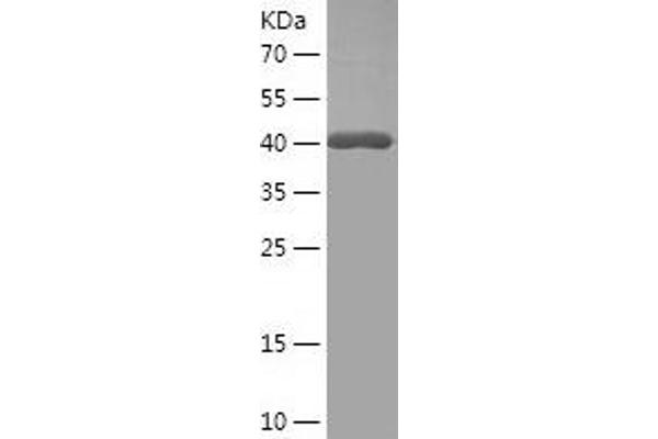 PRL3B1 Protein (AA 32-222) (His-IF2DI Tag)