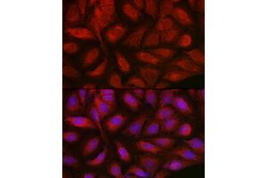 Immunofluorescence analysis of U2OS cells using Endothelin 1 Rabbit pAb (ABIN3021075, ABIN3021076, ABIN3021077 and ABIN6213940) at dilution of 1:50 (40x lens). (Endothelin 1 Antikörper  (AA 18-212))