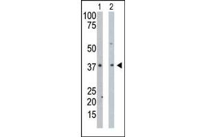 The anti-PDXK Pab (ABIN391110 and ABIN2841241) is used in Western blot to detect PDXK in mouse intestine tissue lysate (Lane 1) and Hela cell lysate (Lane 2).