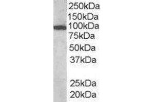 Western Blotting (WB) image for Vav 3 Oncogene (VAV3) peptide (ABIN369869) (Vav 3 Oncogene (VAV3) Peptid)