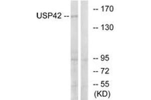 Western blot analysis of extracts from HT-29 cells, using USP42 Antibody.
