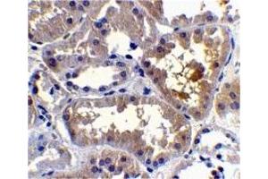 Immunohistochemistry (IHC) image for anti-CASP2 and RIPK1 Domain Containing Adaptor with Death Domain (CRADD) (C-Term) antibody (ABIN1030612)
