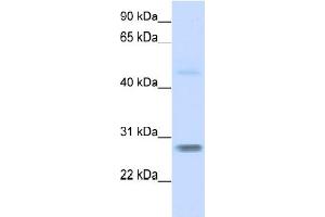 WB Suggested Anti-FBXO25  Antibody Titration: 0. (FBXO25 Antikörper  (N-Term))