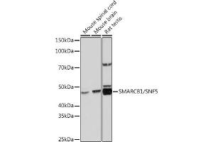 Western blot analysis of extracts of various cell lines, using SM/SNF5 Rabbit mAb (ABIN7270657) at 1:1000 dilution. (SMARCB1 Antikörper)