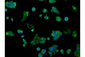 Image no. 2 for anti-Aldo-Keto Reductase Family 1, Member A1 (Aldehyde Reductase) (AKR1A1) antibody (ABIN1496539) (AKR1A1 Antikörper)