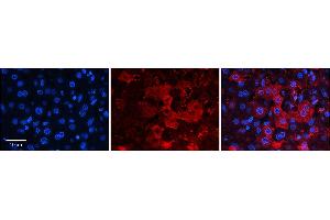 Rabbit Anti-ZNF142 Antibody  Catalog Number: ARP38554_P050 Formalin Fixed Paraffin Embedded Tissue: Human Adult Liver  Observed Staining: Cytoplasm, Membrane in hepatocytes, strong signal, low tissue distribution Primary Antibody Concentration: 1:100 Secondary Antibody: Donkey anti-Rabbit-Cy3 Secondary Antibody Concentration: 1:200 Magnification: 20X Exposure Time: 0.