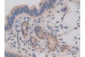 Detection of BMP15 in Mouse Uterus Tissue using Polyclonal Antibody to Bone Morphogenetic Protein 15 (BMP15) (BMP15 Antikörper  (AA 274-390))