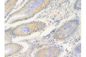 ABIN6264912 and ABIN6269293 at 1/100 staining human normal colon tissue by IHC-P. (RPS6 Antikörper  (C-Term))