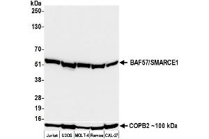Western Blotting (WB) image for anti-SWI/SNF Related, Matrix Associated, Actin Dependent Regulator of Chromatin, Subfamily E, Member 1 (SMARCE1) (C-Term) antibody (ABIN7795730)