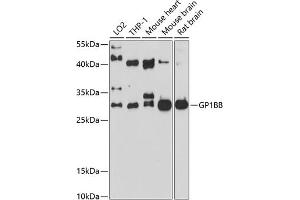 Western blot analysis of extracts of various cell lines, using GP1BB antibody (ABIN6132055, ABIN6141287, ABIN6141288 and ABIN6214244) at 1:1000 dilution. (GP1BB Antikörper  (AA 27-147))