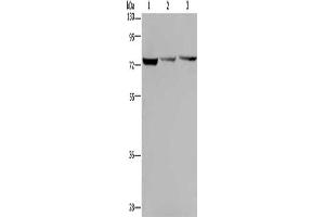 Gel: 8 % SDS-PAGE, Lysate: 40 μg, Lane 1-3: Hela cells, SKOV3 cells, Jurkat cells, Primary antibody: ABIN7130010(KLHL9 Antibody) at dilution 1/300, Secondary antibody: Goat anti rabbit IgG at 1/8000 dilution, Exposure time: 1 minute (KLHL9 Antikörper)