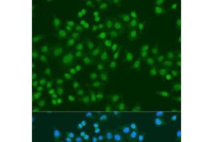 Immunofluorescence analysis of U2OS cells using MSI1 Polyclonal Antibody at dilution of 1:100. (MSI1 Antikörper)