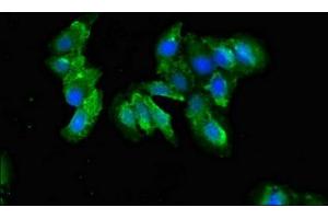 Immunofluorescent analysis of Hela cells using ABIN7148332 at dilution of 1:100 and Alexa Fluor 488-congugated AffiniPure Goat Anti-Rabbit IgG(H+L) (C1QA Antikörper  (AA 26-125))