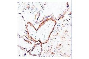 Immunohistochemical analysis of paraffin embedded human placenta sections; staining in cytoplysm; DAB chromogenic reaction (PLGF Antikörper  (N-Term))