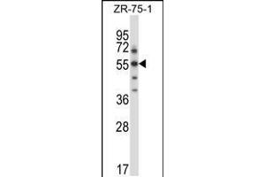Western blot analysis in ZR-75-1 cell line lysates (35ug/lane). (SGK3 Antikörper  (C-Term))