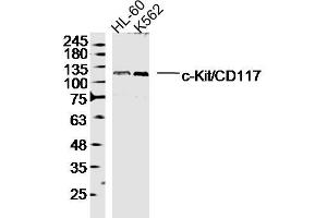 Lane 1: HL-60 lysates Lane 2: K562 lysates probed with c-Kit/CD117 Polyclonal Antibody, Unconjugated  at 1:300 dilution and 4˚C overnight incubation. (KIT Antikörper  (AA 451-550))