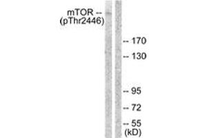 Western Blotting (WB) image for anti-Mechanistic Target of Rapamycin (serine/threonine Kinase) (mTOR) (AA 2412-2461), (pThr2446) antibody (ABIN1531715)