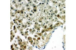 Anti-Peroxiredoxin 5 antibody, IHC(P) IHC(P): Rat Liver Tissue (Peroxiredoxin 5 Antikörper  (C-Term))