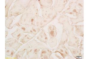 Formalin-fixed and paraffin embedded rat skeletal muscle labeled with Rabbit Anti MYPN Polyclonal Antibody, Unconjugated (ABIN1714212) at 1:200 followed by conjugation to the secondary antibody and DAB staining (Myopalladin Antikörper  (AA 901-1000))