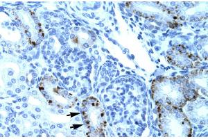 Human kidney (TCFL5 Antikörper  (Middle Region))