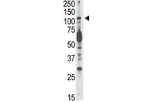 Western Blotting (WB) image for anti-Phosphoinositide-3-Kinase, Catalytic, delta Polypeptide (PIK3CD) antibody (ABIN3003631) (PIK3CD Antikörper)