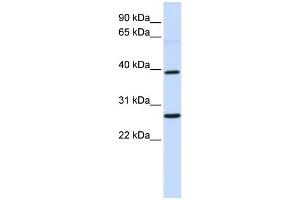 WB Suggested Anti-WNT16 Antibody Titration:  0. (WNT16 Antikörper  (Middle Region))
