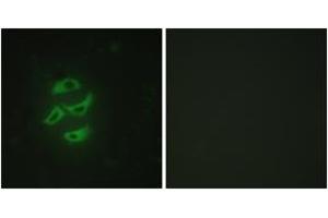 Immunofluorescence analysis of HepG2 cells, using Cytochrome P450 2J2 Antibody.
