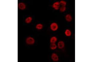 ABIN6274072 staining K562 by IF/ICC. (CDKN1C Antikörper  (pThr310))