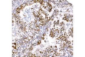 IHC analysis of COX6B1 using anti-COX6B1 antibody (ABIN7603206). (COX6B1 Antikörper  (N-Term))