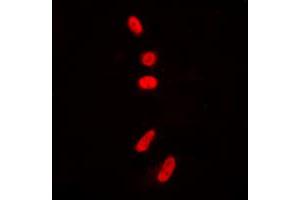 Immunofluorescent analysis of p53 (AcK381) staining in HeLa cells. (p53 Antikörper  (acLys381, C-Term))