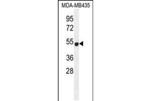 Western blot analysis in MDA-MB435 cell line lysates (35ug/lane).