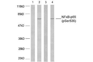 Western blot analysis using NF-κB p65 (phospho-Ser536) antibody (E011014). (NF-kB p65 Antikörper  (pSer536))