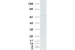 Western Blotting (WB) image for Nuclear Receptor Subfamily 1, Group D, Member 2 (NR1D2) (Transcript Variant 1) protein (Myc-DYKDDDDK Tag) (ABIN2727541)