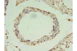 Immunohistochemistry of paraffin-embedded human testis tissue using ABIN7176283 at dilution of 1:100 (ZNF397 Antikörper  (AA 1-275))