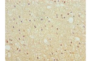 Immunohistochemistry of paraffin-embedded human brain tissue using ABIN7151639 at dilution of 1:100