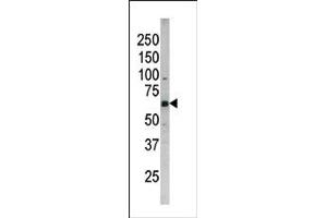 Image no. 1 for anti-Cell Division Cycle 25 Homolog B (S. Pombe) (CDC25B) (pSer187) antibody (ABIN358100)