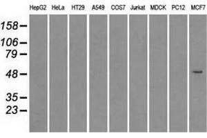 Immunoprecipitation(IP) of SLC2A5 by using TrueMab monoclonal anti-SLC2A5 antibodies (Negative control: IP without adding anti-SLC2A5 antibody. (SLC2A5 Antikörper)